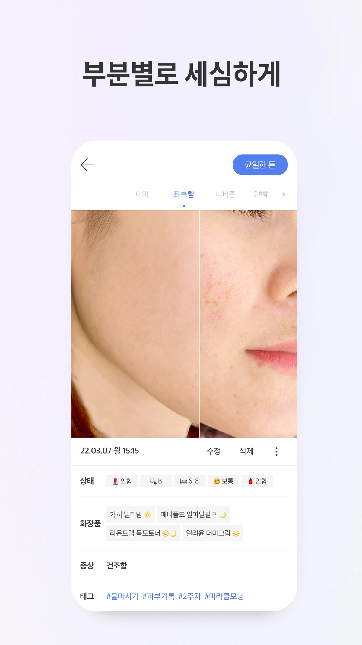 스킨로그 스크린샷 4