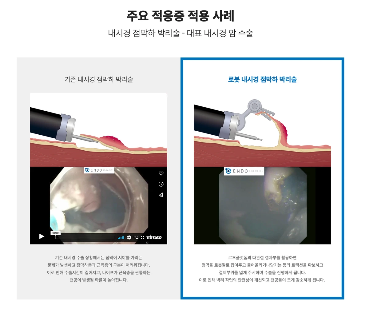 엔도로보틱스 스크린샷 3