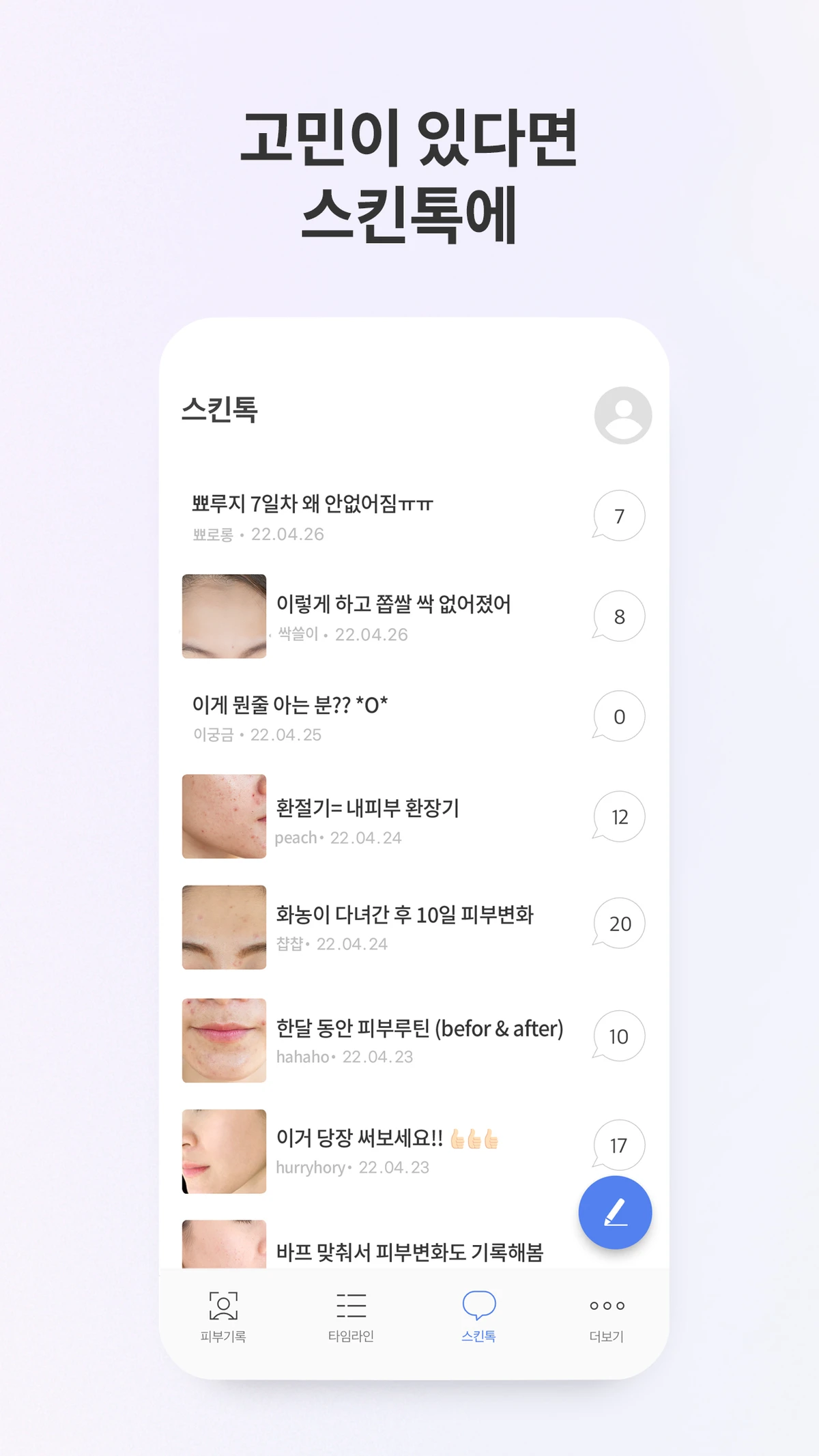 스킨로그 스크린샷 5